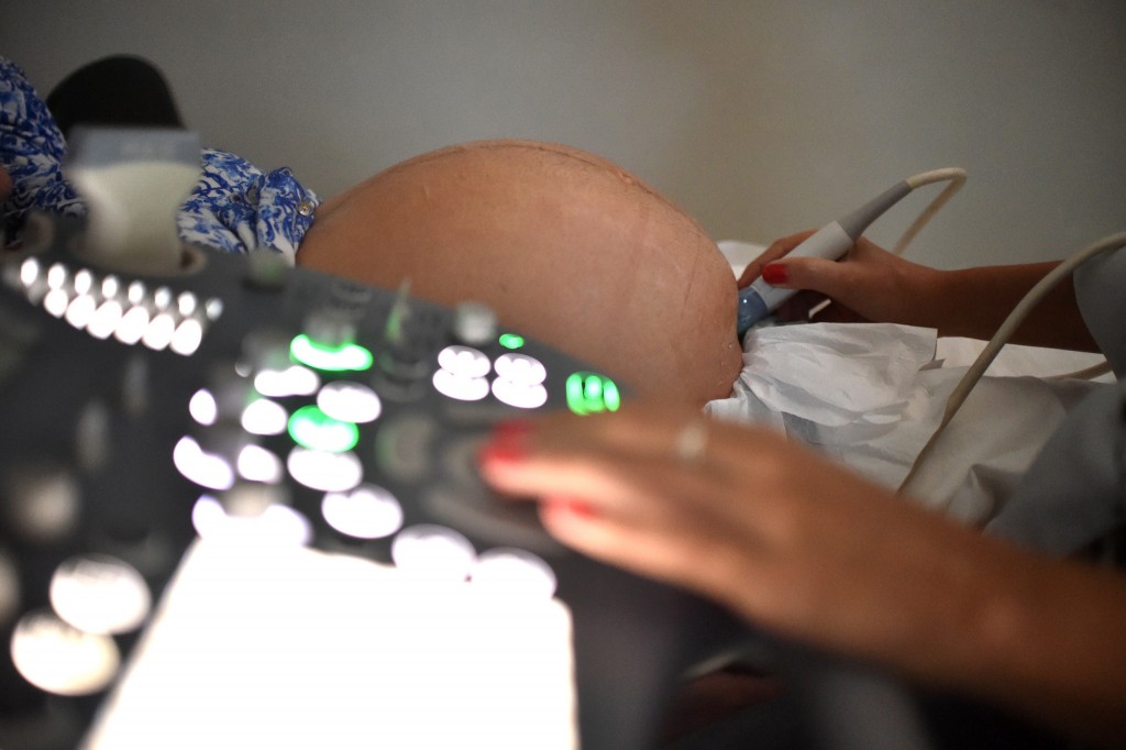 Pregnant woman. ©Agência Brasília/Flickr/CC BY 2.0