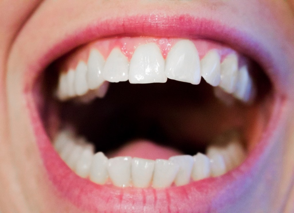 Open mouth | © Kjerstin_Michaela/pixabay