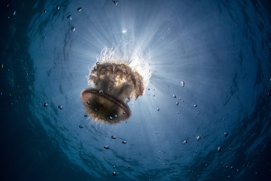 How To Treat A Jellyfish Sting and No Don t Pee On It 